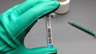 Врач Пшеничная: тесты могут не выявить коронавирус на четвертый день болезни