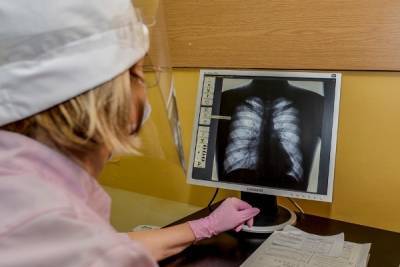 Рентгенолог предрёк исчезновение флюорографии как метода диагностики