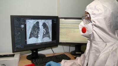 Пензенские медики отметили День рентгенолога