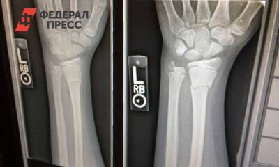 Дорогостоящий рентген-комплекс начнет работу в больнице Шарыпово