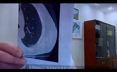 В Нижневартовске зовут население вакцинироваться, показывая фото органов покойников