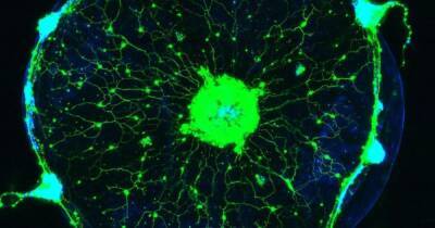 Ученые научились читать мысли медуз, поместив их нервную систему под микроскоп (фото)
