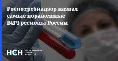 Роспотребнадзор назвал самые пораженные ВИЧ регионы России