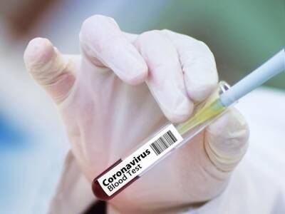 Врач Чурадзе рассказал, как обнаружить «замаскированный» коронавирус