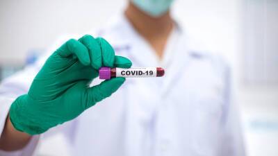В России за сутки выявили 30 873 новых случая COVID-19