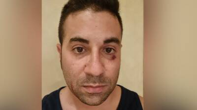 Подросток избил мужчину на глазах у детей за просьбу надеть маску в лифте эйлатского отеля