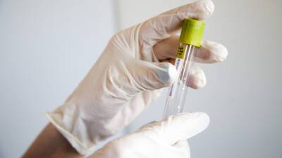 В России за сутки коронавирус выявили у 30 288 человек