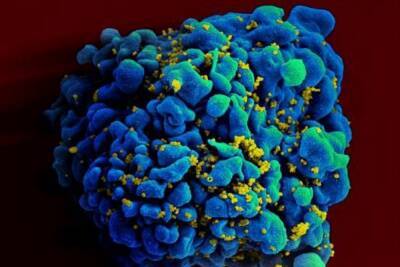 Ученые из США успешно протестировали на животных мРНК-вакцину от ВИЧ