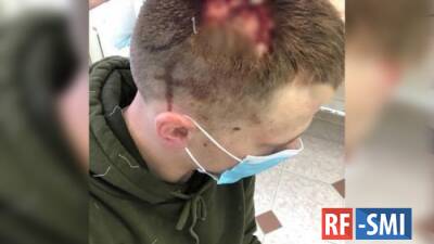 В Крыму рассказали правду о «пострадавшем» парне от полицейских