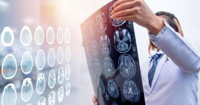 Ученые из России создали новый метод диагностики заболеваний мозга