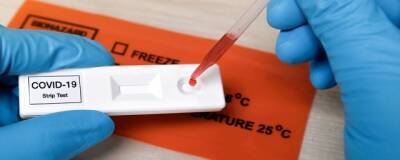 В ЮАР сообщили о признаках замедления вспышки омикрон-штамма COVID-19