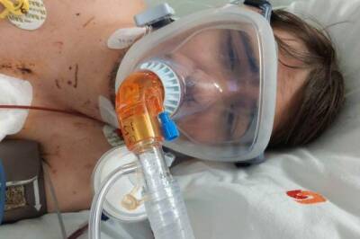 В Новосибирске 29-летний мужчина скончался от COVID-19 после операции на сердце