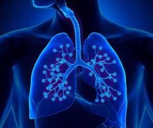 Как быстро может возникнуть пневмония при заражении Омикроном: объясняет врач
