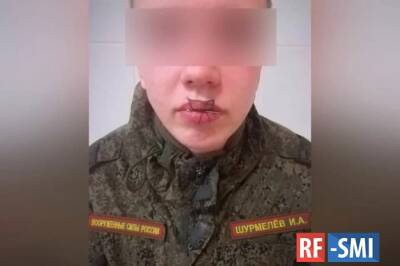 В Челябинской области солдат зашил себе рот после ссоры с девушкой