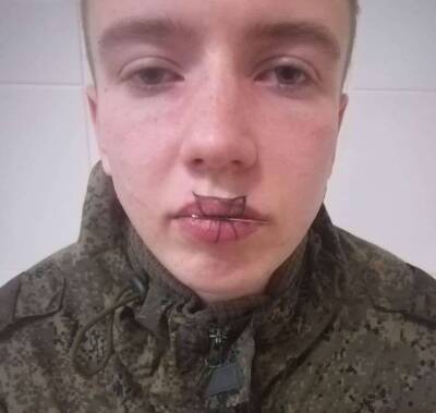 В Челябинской области солдат-срочник зашил себе рот после ссоры с девушкой - Русская семерка
