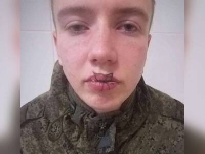 «У него просто крыша поехала»: в воинской части под Челябинском срочник зашил себе рот после ссоры с девушкой