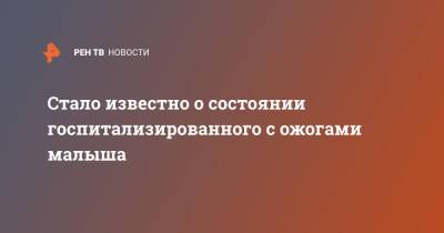 Стало известно о состоянии госпитализированного с ожогами малыша