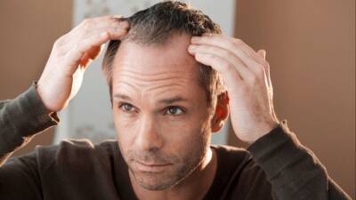 Пора к психологу: ТОП неожиданных причин выпадения волос