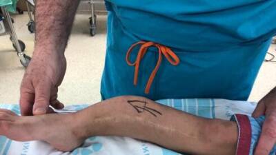 Хирург Марк Эйдельман превратил мальчика с врожденным дефектом ноги в футболиста