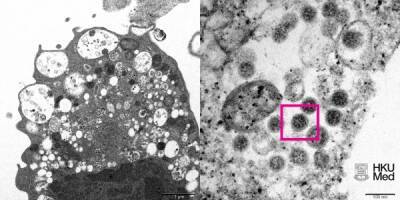 Вирусолог: Для нейтрализации омикрон-штамма, вероятно, требуется в 40 раз больше антител