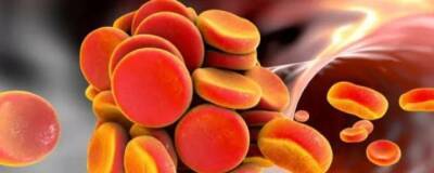 Кардиолог Чернушенко рассказала россиянам о профилактических мерах против тромбоза