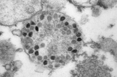 Опубликованы первые фото штамма коронавируса «омикрон»