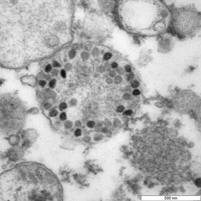 "Вектор" представил фотографии омикрон-штамма коронавируса
