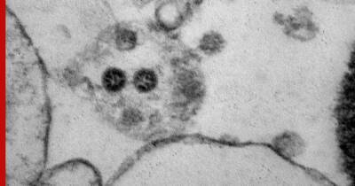 Российские ученые показали фотографии омикрон-штамма COVID-19