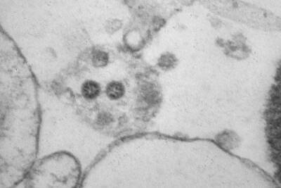 Учёные сфотографировали штамм коронавируса «омикрон»