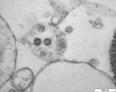 Омикрон-штамм коронавируса стал доминирующим в США – ЦКЗ