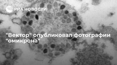 Центр "Вектор" опубликовал фотографии штамма коронавируса "омикрон"