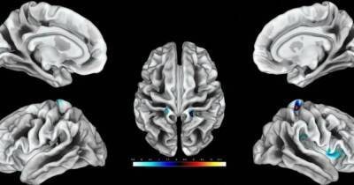 Найдена область мозга, отвечающая за клитор: она растет от большого количества секса