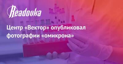 Центр «Вектор» опубликовал фотографии «омикрона» - readovka.news