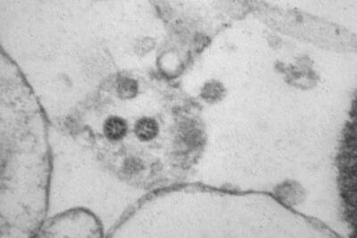 Как выглядят клетки, заражённые «омикроном»: фото учёных
