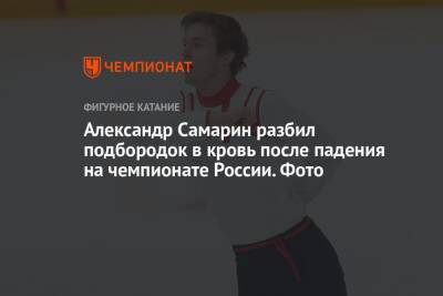 Александр Самарин разбил подбородок в кровь после падения на чемпионате России. Фото