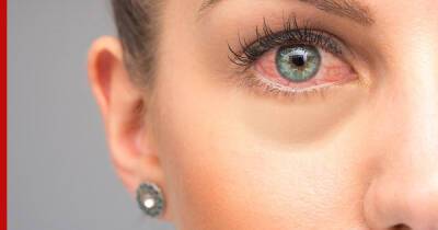 Качество зрения: причины покраснения глаз назвали специалисты
