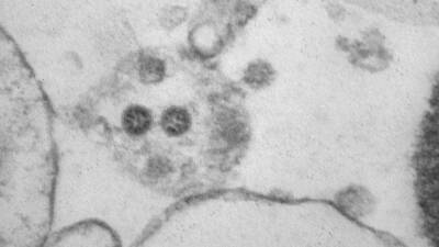 Research Square: вирус SARS-CoV-2 может сохраняться в организме в течение многих месяцев