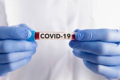 В Новгородской области COVID-19 диагностировали еще у 147 человек