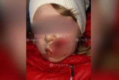 В пригороде Краснодара собака напала на маленькую девочку