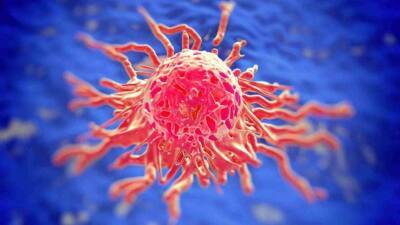 Ключевой признак наличия рака назвал онколог