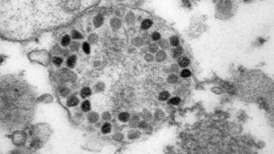 Ученые нашли нейтрализующие «Омикрон» антитела