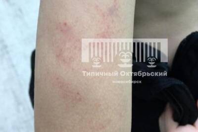 Воспитателя обвинили в избиении ребенка в детсаду Новосибирска