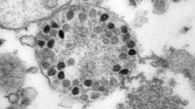 Попова сравнила заразность штамма «Омикрон» с другими вариантами коронавируса