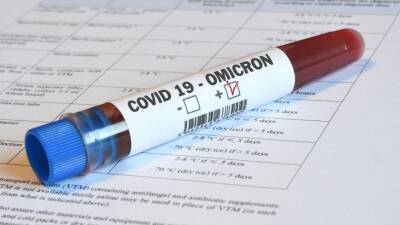 «Омикрон» стал самым заразным штаммом COVID-19 из-за «очеловечивания»