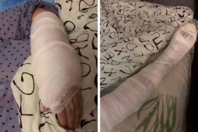 Ну Урале женщина получила перелом руки в травмпункте, куда приехала со сломанной ногой