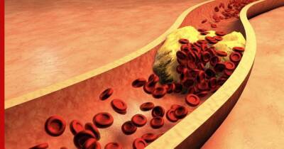 Против высокого холестерина: продукты на каждый день для чистых сосудов назвала кардиолог