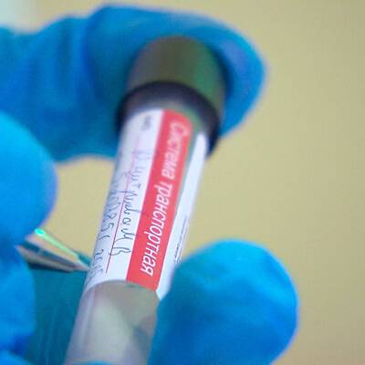 Срок действия ПЦР-теста на коронавирус сократили с 72 до 48 часов