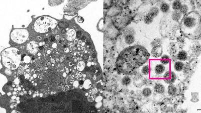 Опубликована микрофотография штамма коронавируса «Омикрон»