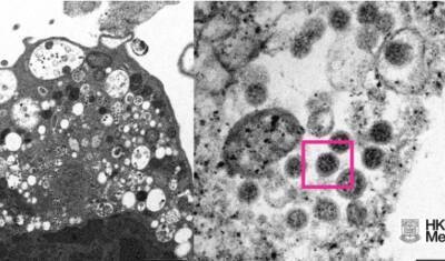 Гонконгские ученые опубликовали первое фото штамма коронавируса «Омикрон»