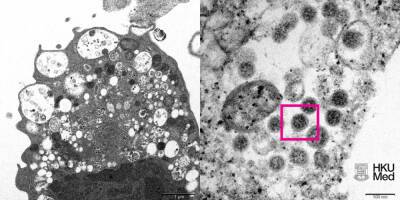 Китайские ученые показали первый снимок штамма коронавируса "омикрон"
